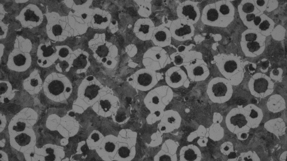 Tổ chức tế vi của gang cầu Ferrite/Peclite (X100)